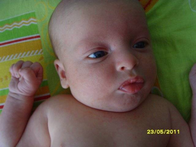 Новорожденный синеет при кормлении. синий носогубный треугольник у грудничка