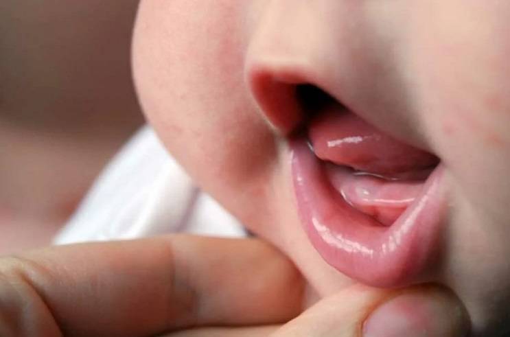 Температура при прорезывании зубов у детей: причины, сколько дней держится и как ее снизить?