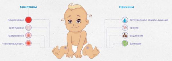 Раздражение на попе - раздражение на попе у новорожденного - запись пользователя mila-ya (ludashka) в сообществе здоровье новорожденных в категории кожные заболевания - babyblog.ru