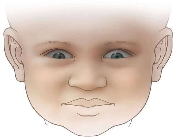 Голова не выравнивается - запись пользователя людмила (mamalapsika) в сообществе здоровье новорожденных в категории ортопедия - babyblog.ru