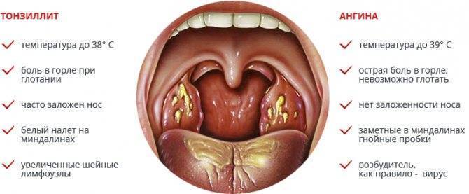 Здоровое горло – как должно выглядеть, фото