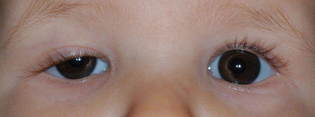 Самые распространенные заболевания глаз у детей: причины, симптомы, лечение