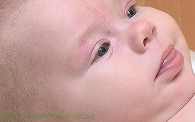 Причины появления и лечение язвочек во рту у ребенка