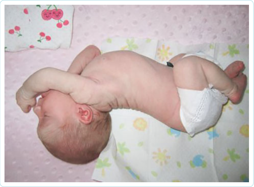Выгибает спинку и запрокидывает голову! - грудничок выгибает спину и запрокидывает голову - запись пользователя счастливая мама (buzova1234) в сообществе здоровье новорожденных в категории разное - babyblog.ru