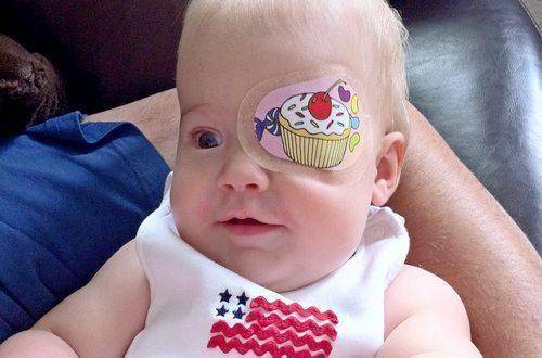 Почему косят глаза у новорожденного