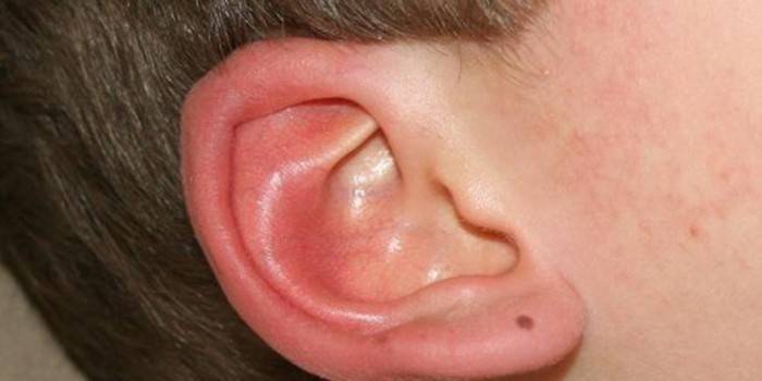 Кровь из ушей: причины и лечение