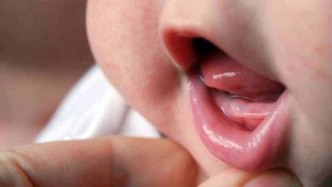 Зубки пипец. (фото)прорезывание зубов у детей, у грудничков