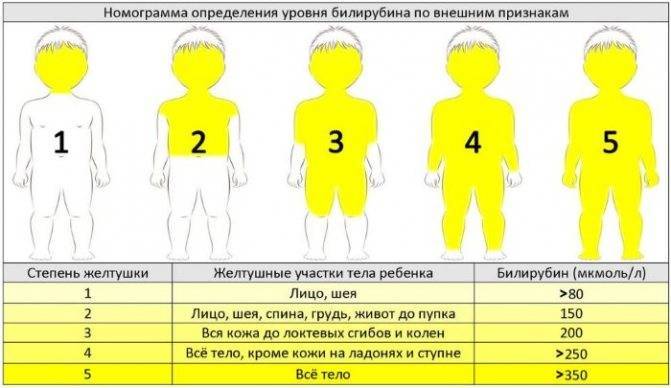 Как понять, что у грудничка болит горло — советы родителям