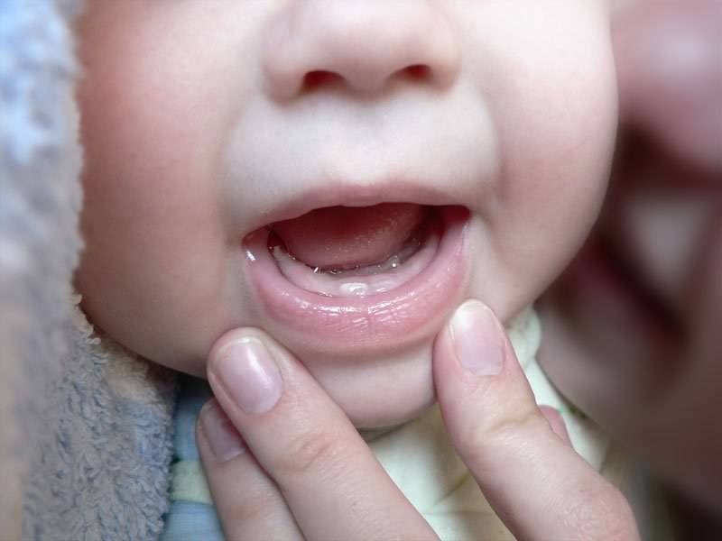 Рвота при прорезывании зубов у детей: может ли быть от зубов, бывает ли и что делать