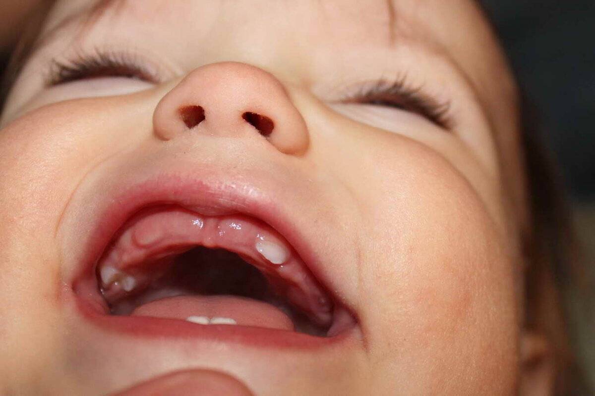 Как у детей прорезаются зубы