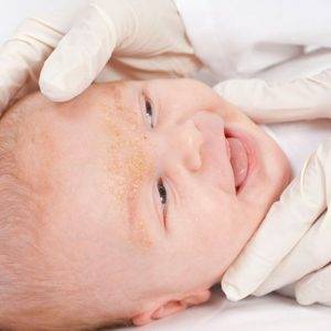 Доктор комаровский о том, как убрать корочки на голове у младенца