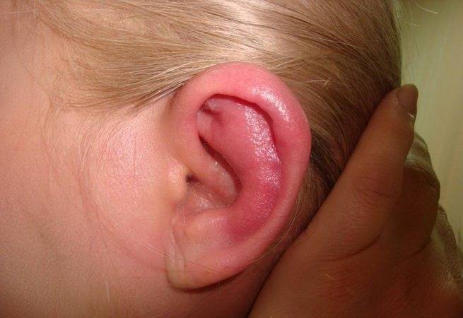 Кровь из уха у ребенка: почему она пошла при чистке и что при этом делать?