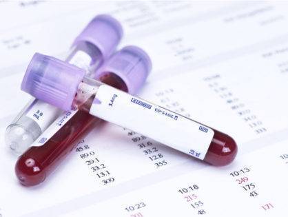 Общий анализ крови у детей: расшифровка и нормы