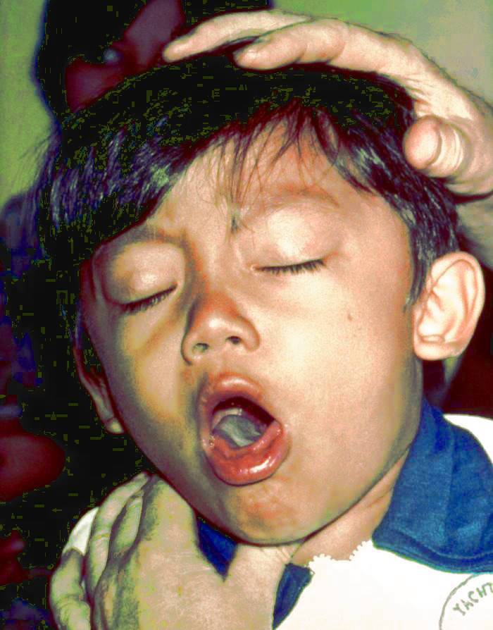 У ребенка ночью закладывает нос, он плохо дышит: почему и что делать