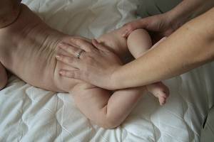 Разное количество складок на ножках - запись пользователя марина (argentinna) в сообществе здоровье новорожденных в категории ортопедия - babyblog.ru