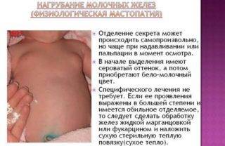 Деформация грудной клетки у ребенка