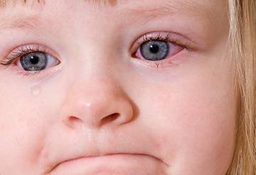 У ребенка опух глаз — возможные причины, тревожные симптомы