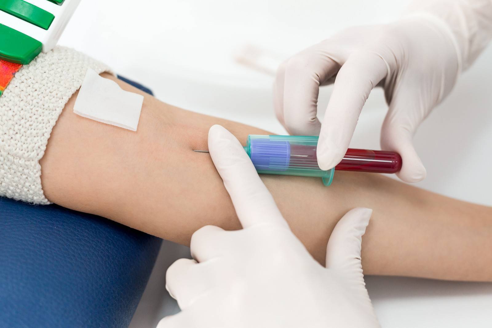 Общий анализ крови у ребенка: о чем вам скажут цифры?