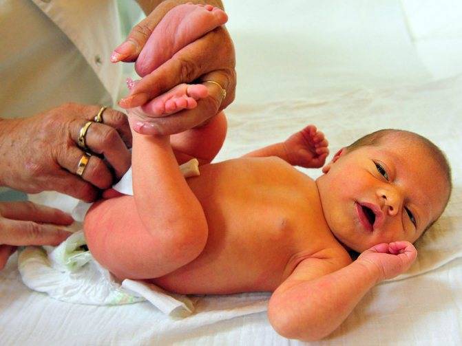 Причины появления родовых пятен (послеродовых) у новорожденных: когда проходят и как ускорить процесс исчезновения