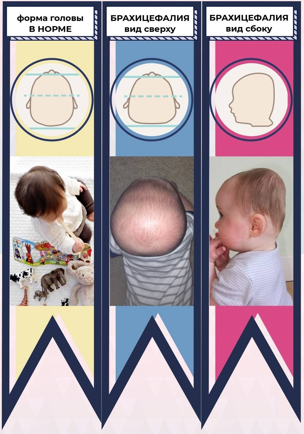 Неровная голова в 2 месяца( - запись пользователя anastasia (id1127961) в сообществе здоровье новорожденных в категории рахит и его профилактика - babyblog.ru