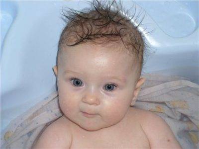 У ребенка плохо растут волосы в 1-2 года: причины, способы стимуляции роста, мнения врачей