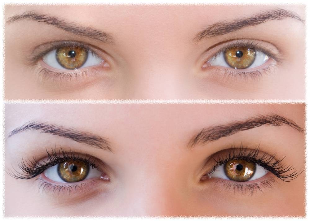 Пленка на глазах: причины, лечение и профилактика