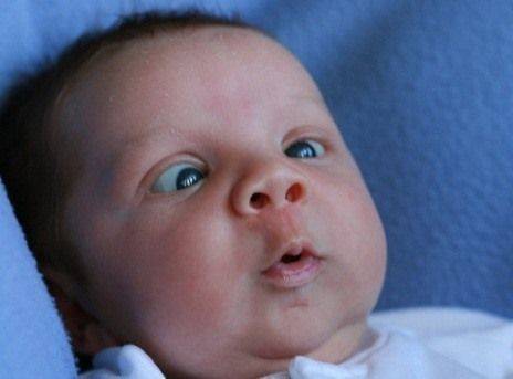 Глазки при засыпании - запись пользователя сочнеенебывает (id1854585) в сообществе здоровье новорожденных в категории разное - babyblog.ru