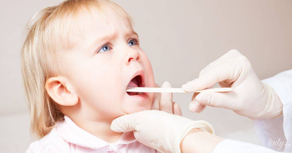 Как выглядит здоровое горло у ребенка и больное (27 фото): нормальное и воспаленное, при аденоидах, рыхлое горло и с красными точками