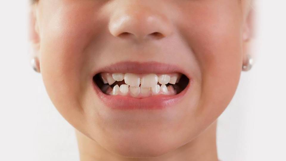 Могут ли резаться первые молочные зубы в 2 месяца: обращаем внимание на признаки