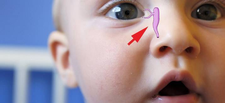 Массаж слезного канала у новорожденных: советы при дакриоцистите