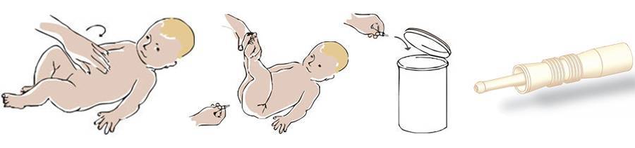 Газоотводная трубка для новорожденных — инструкция