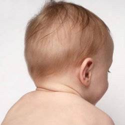 Правильная и неправильная форма черепа новорожденного ребенка, виды деформации головки – что является патологией?