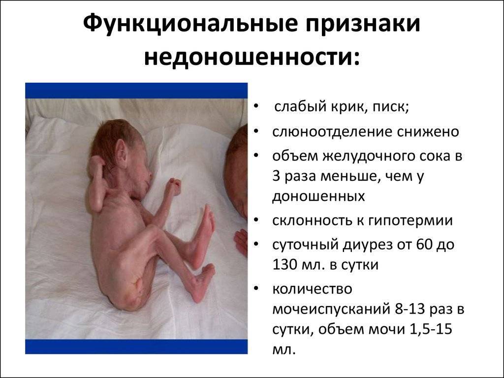 Недоношенные дети - особенности развития по месяцам до года, питание, набор веса и уход за новорожденным