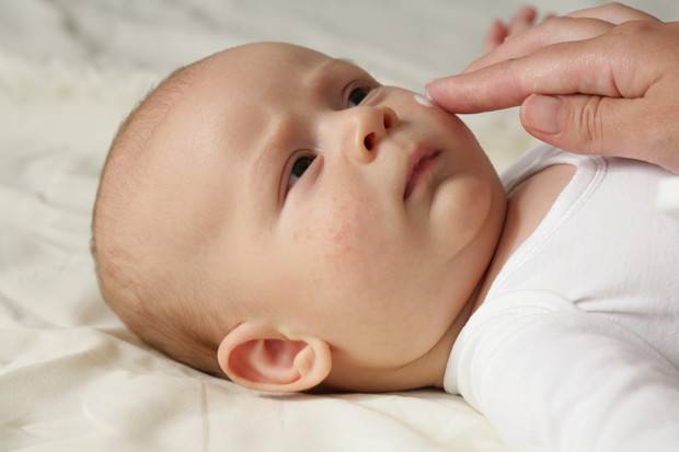 Аллергия у новорожденного: основные проявления, симптомы и варианты лечения (95 фото + видео)