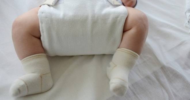 Симптомы и лечение дисплазии тазобедренного сустава у новорожденных