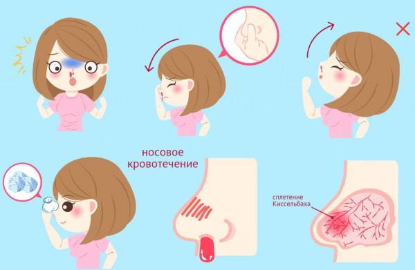 Аспиратор для новорожденных: какой лучше для носа и как пользоваться назальным соплеотсосом