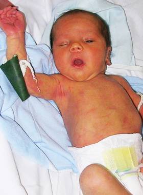 Анатомо физиологические особенности новорожденного ребенка