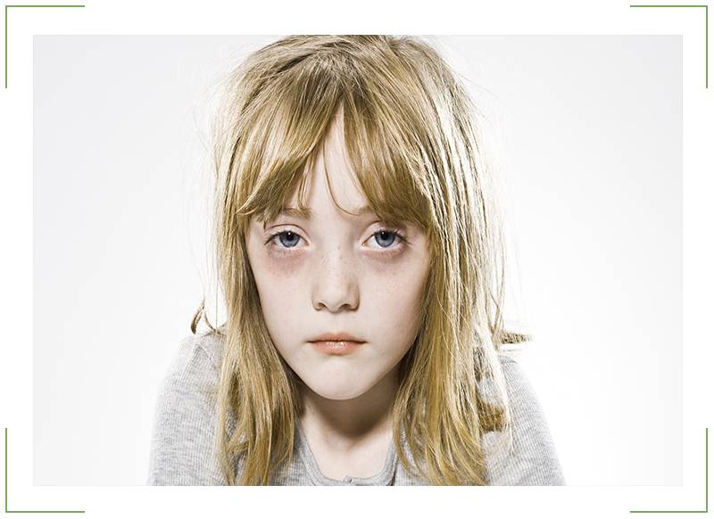 Коричневые синяки под глазами у ребенка. почему у ребенка синяки под глазами
