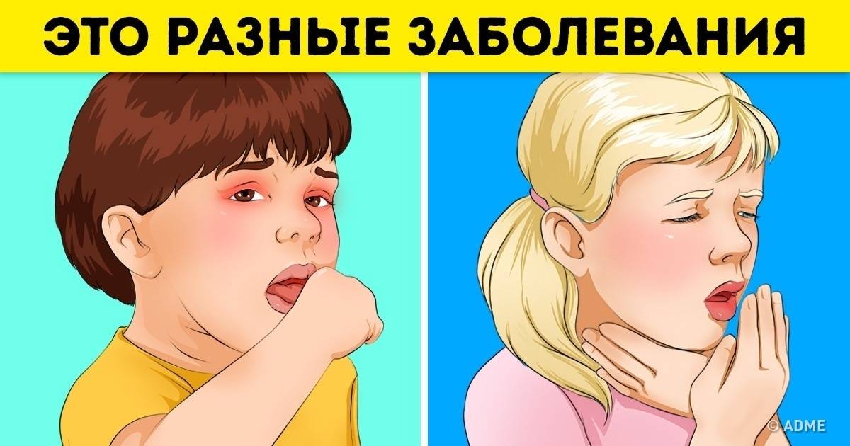 Как понять, что у грудничка болит горло: чем лечить ребенка до года или новорожденного