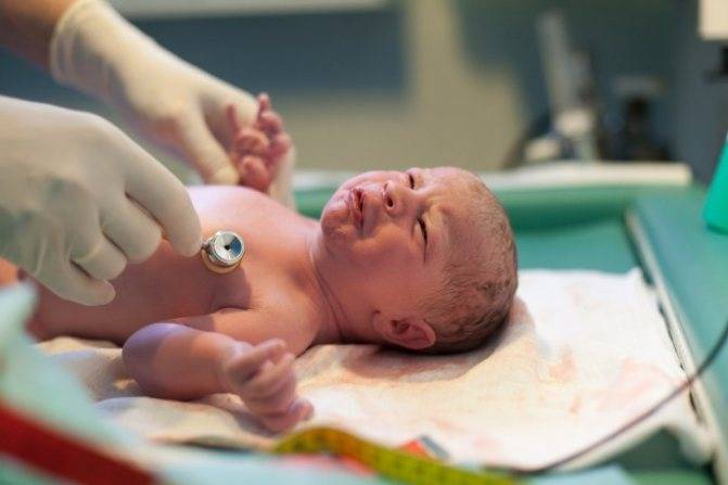 Ишемия головного мозга у новорожденного: что это, последствия и лечение, степени и особенности поражения у недоношенных детей
