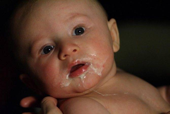 Пилоростеноз у новорожденных детей – причины, симптомы и лечение