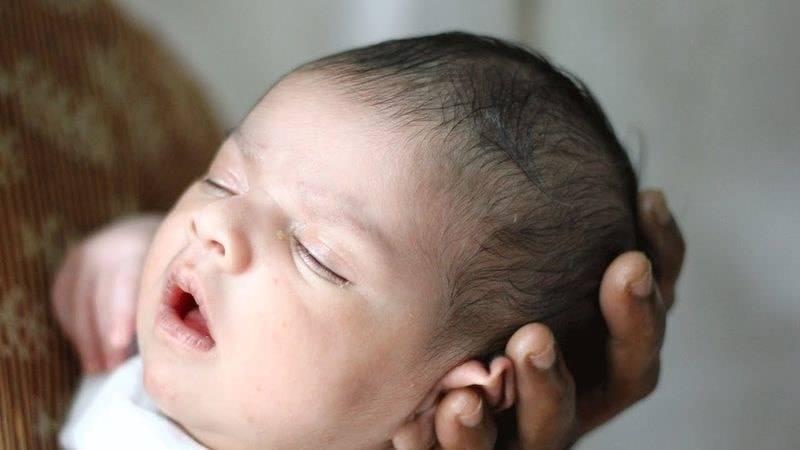 Череп новорожденного: анатомия, причины деформации, условия выравнивания