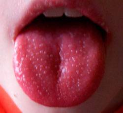 Что делать, если у ребенка болит горло и чем его лечить?