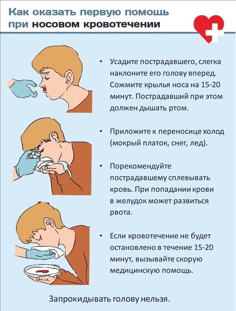 Кровь из носа у ребенка: причины носовых кровотечений, почему часто идет кровь, как остановить