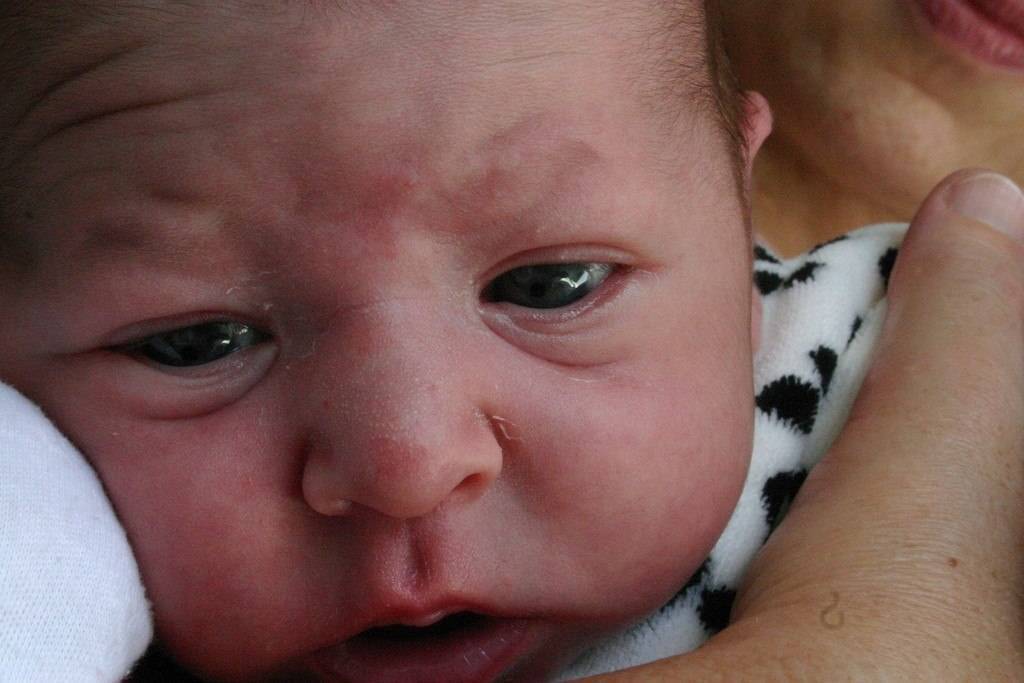 Выделения из глаз у новорожденного — причины появления слизи