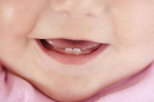 Сколько зубов у ребенка в 1 год