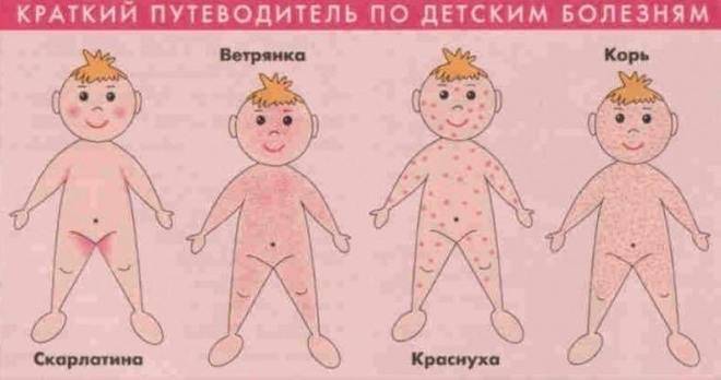 Сыпь на теле у ребенка фото с пояснениями