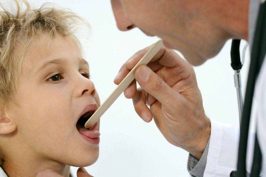 Как лечить горло и сильный кашель у ребенка