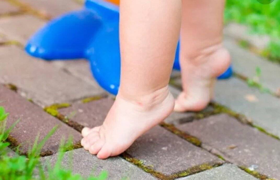 Ребенок ходит на носочках в год — что делать
