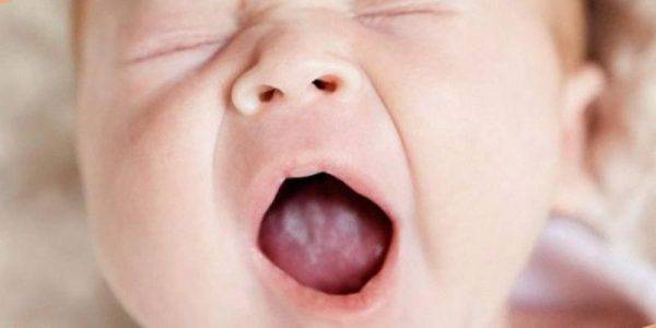 На какое заболевание указывает сыпь у ребенка во рту?